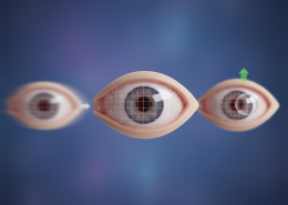 Astigmat kendi kendine zamanla geçer mi?